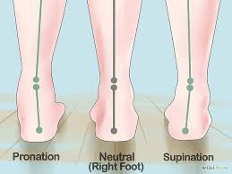 Underpronation, Supinated and High Arched Foot