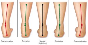Foot pain diagram