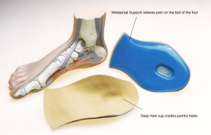 treating plantar fasciitis